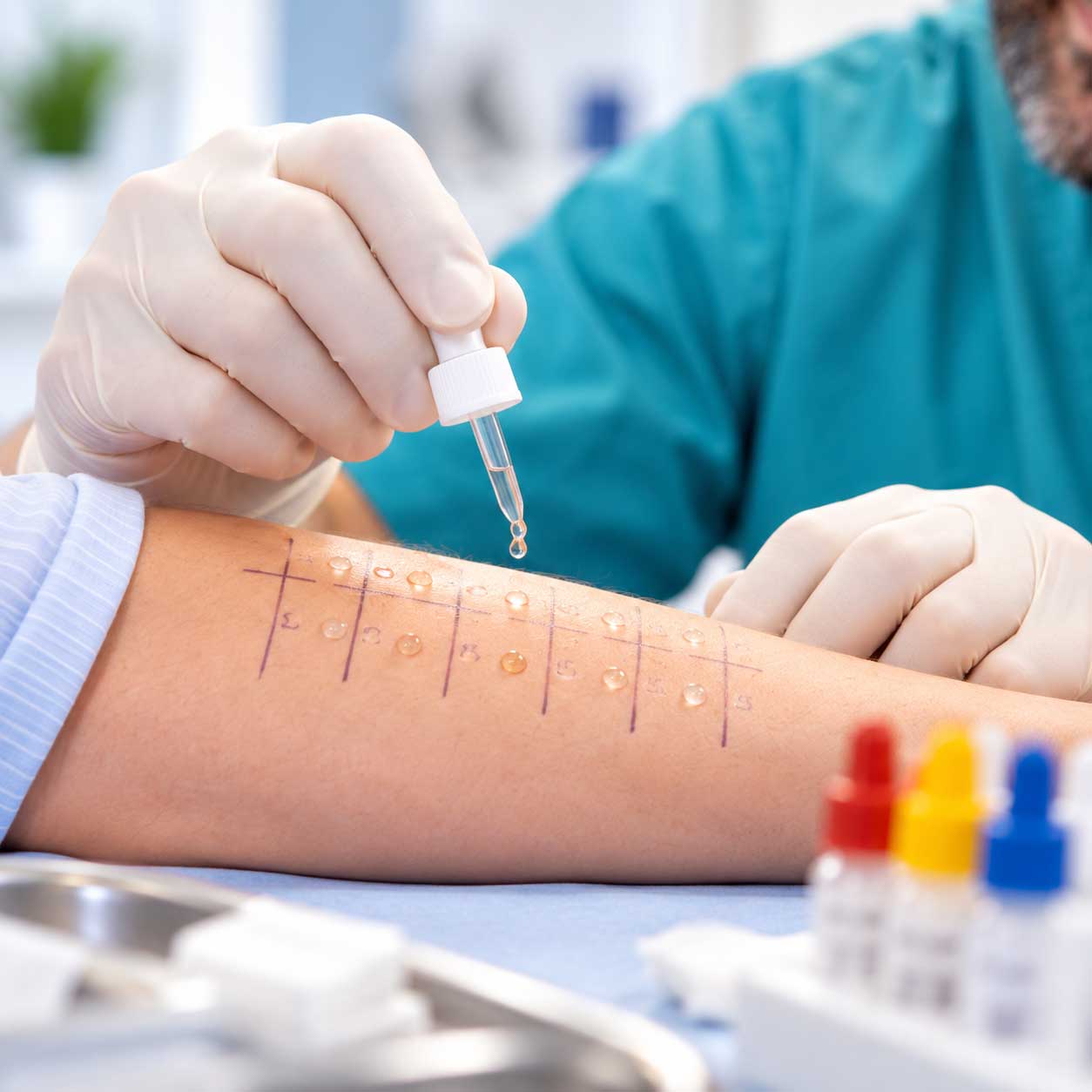 Allergietest beim HNO Dannemann in Gummersbach